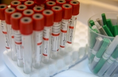 Минздрав Приморья: Тестироваться на антитела перед вакцинацией от COVID-19 необязательно
